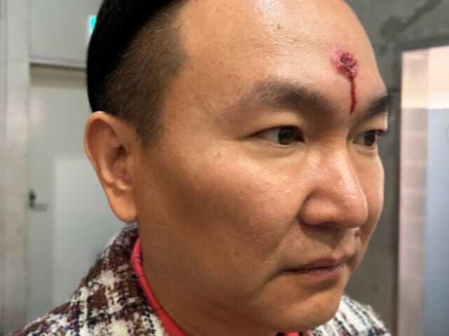 お笑いコンビ・かまいたちの山内健司さんは3月18日、自身のInstagramを更新。ニュース記事のサムネイル画像に「これ俺?」とツッコみました。(サムネイル画像出典:山内健司さん公式Instagramより)